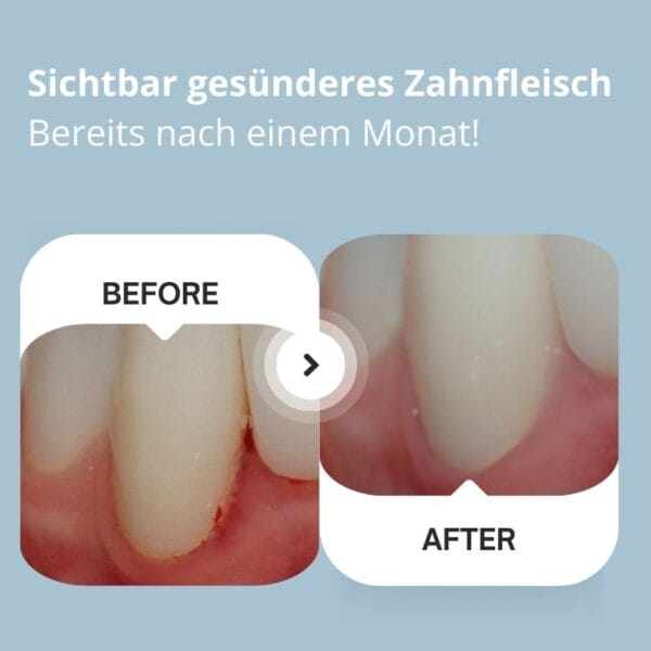 edel+white Sonic Generation Health Suite sonic toothbrush - Cleaning performance Very good. Visibly healthier gums after just one month. Recommended by Swiss dental professionals. 